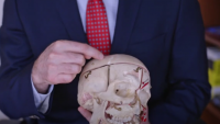 photo of doctor pointing at skull